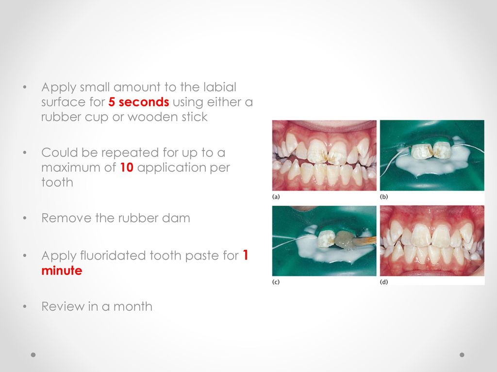 Advanced Restorative Dentistry Ppt Download