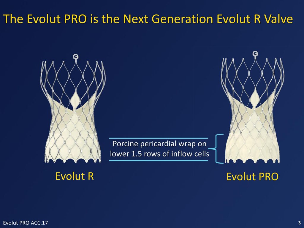 Porcine pericardial wrap on lower 1.5 rows of inflow cells