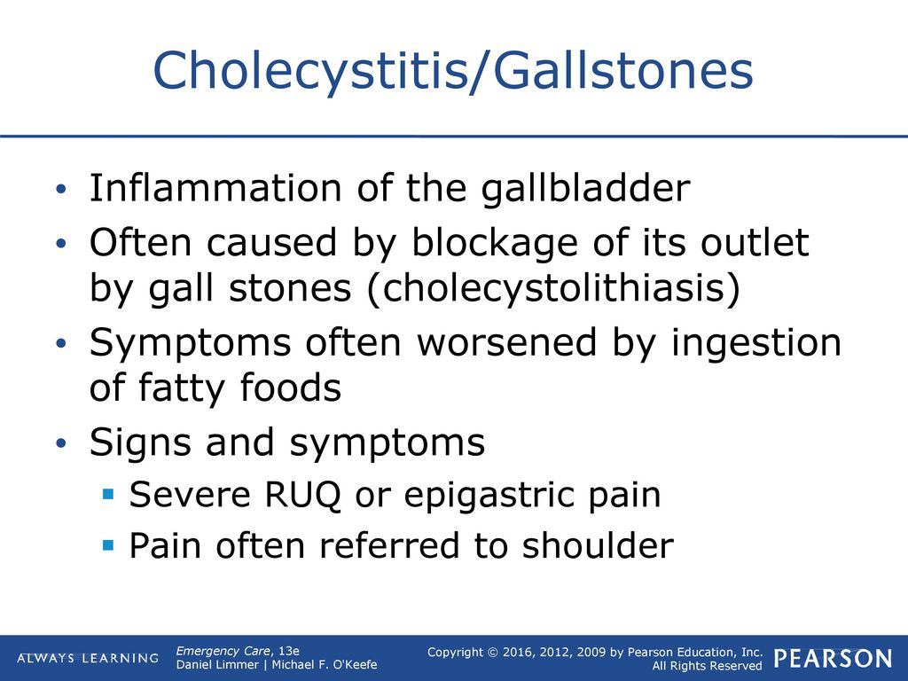 Cholecystitis/Gallstones