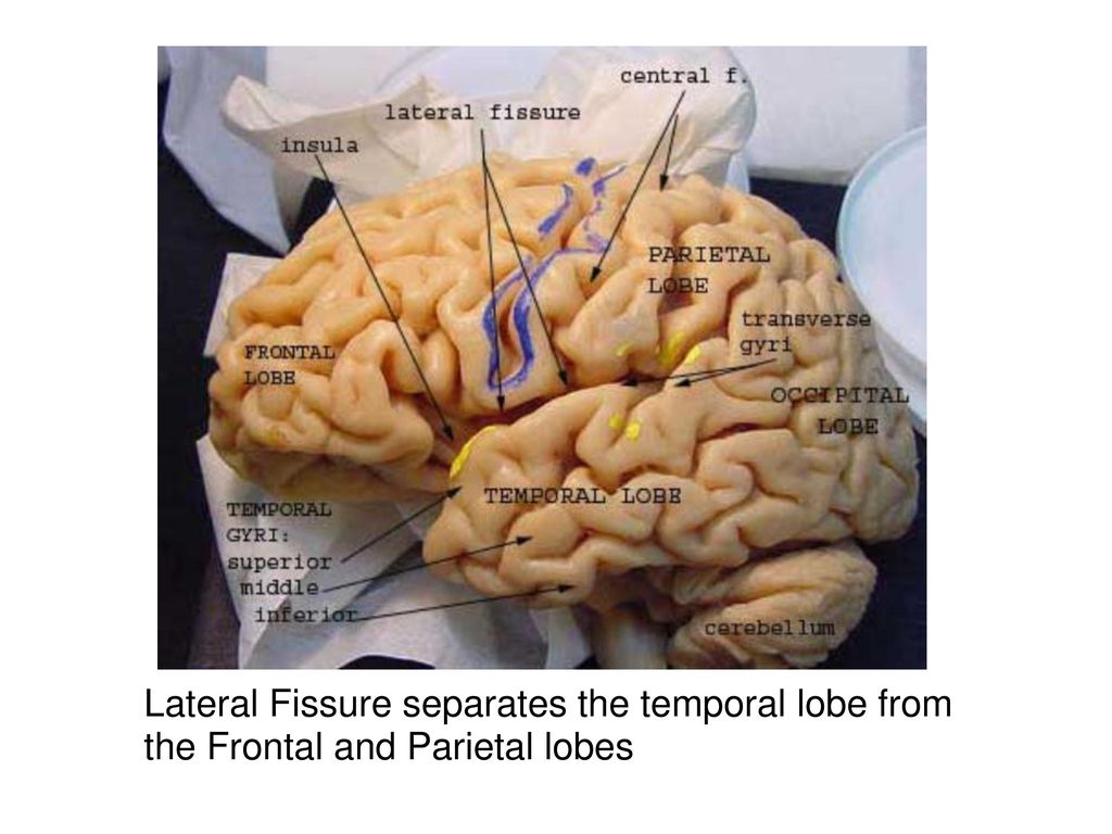 Sheep Brain Dissection Lab - ppt download With Regard To Sheep Brain Dissection Worksheet