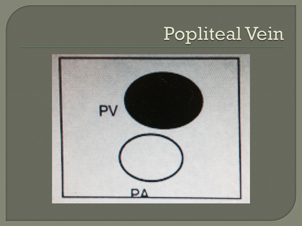 Venous Duplex / Color Flow Imaging - ppt download