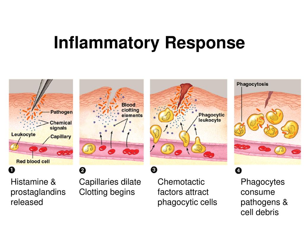 The Nature of Disease Pathogenic Organisms Genetic Disorders Biology Diagrams