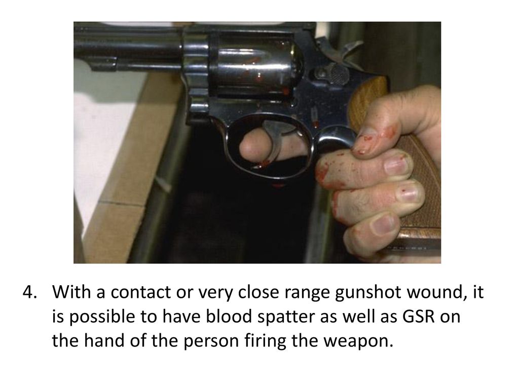 With a contact or very close range gunshot wound, it is possible to have blood spatter as well as GSR on the hand of the person firing the weapon.