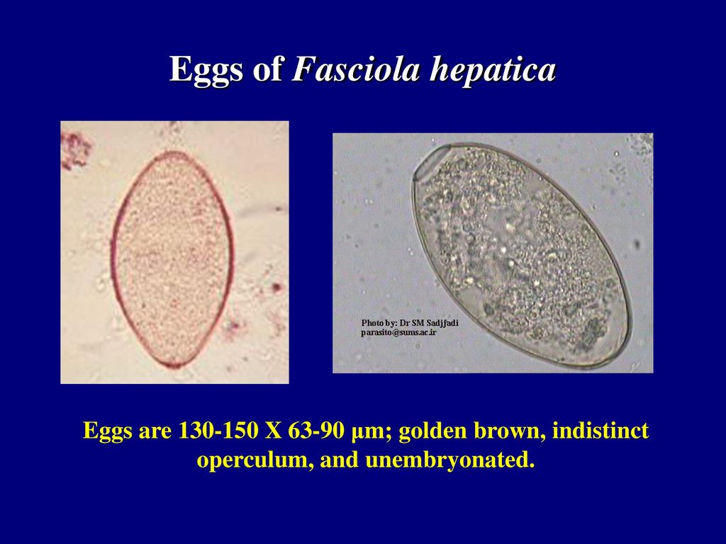 Яйцо печеночного. Fasciola hepatica яйца. Fasciola hepatica яйца строение. Яйца Fasciola hepatica под микроскопом. Яйца гельминтов Fasciola hepatica.