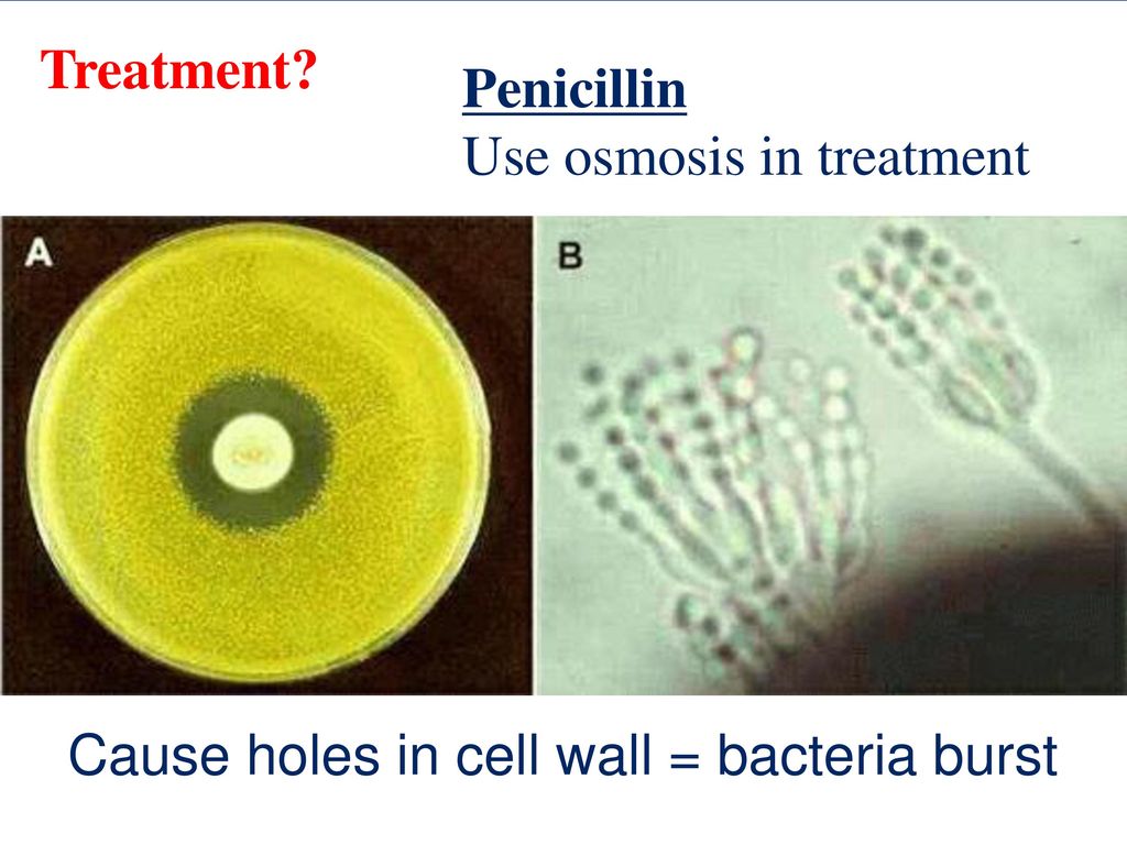 Пеницилл и бактерии. Плесень пеницилл микроскоп. Пенициллин бактерии. Пенициллин антагонизм.