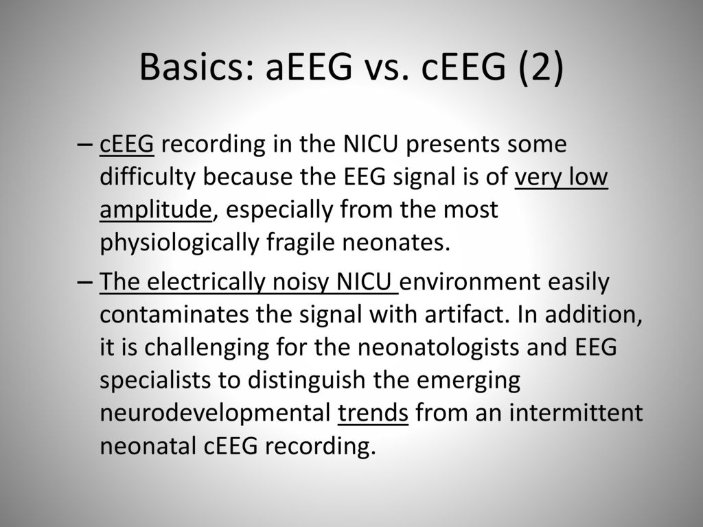 Neonatal Seizures In Amplitude Integrated Eeg Ppt Download