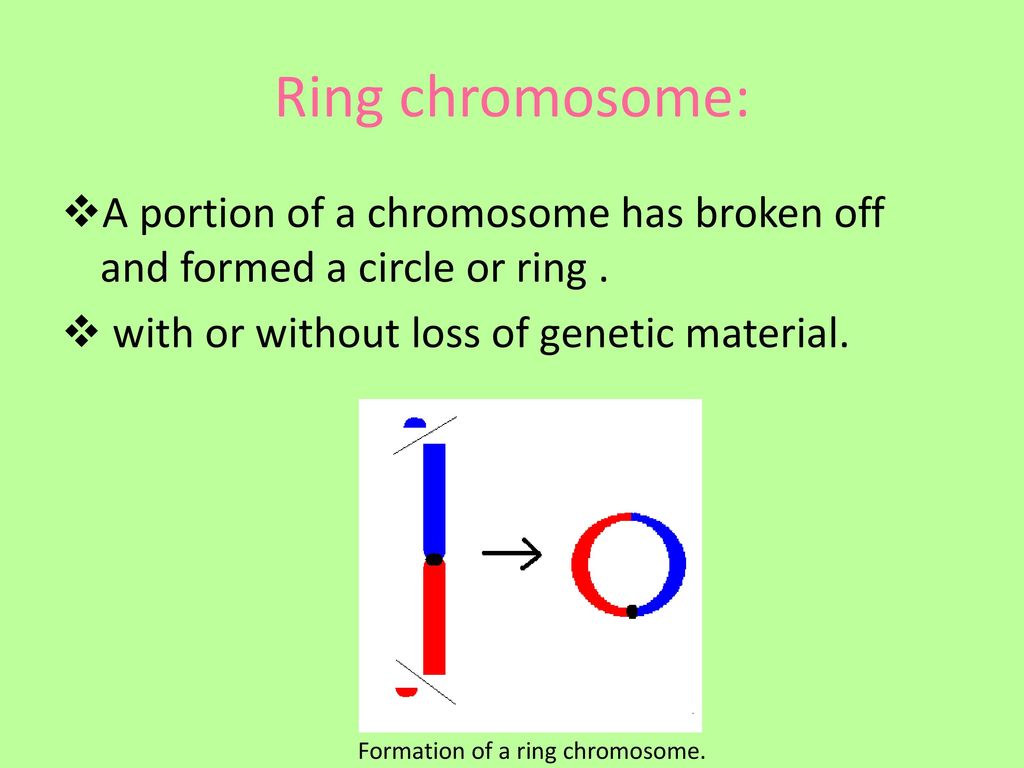 A Comprehensive and Clinical Review of Chromosome 9 Ring Syndrome