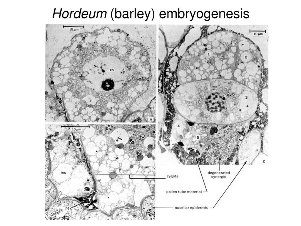 Hordeum (barley) embryogenesis