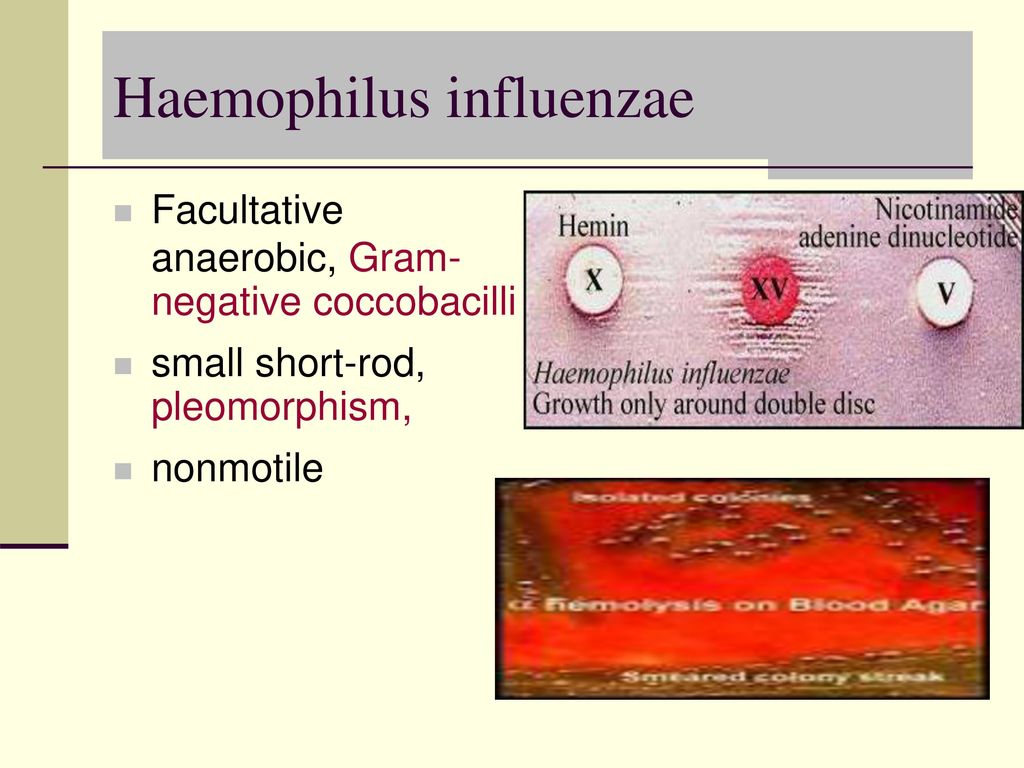 Upper and Lower Respiratory Tract Infection - ppt download