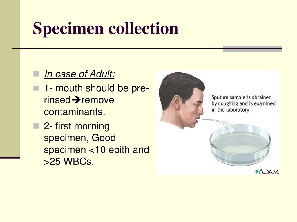Specimen collection In case of Adult: