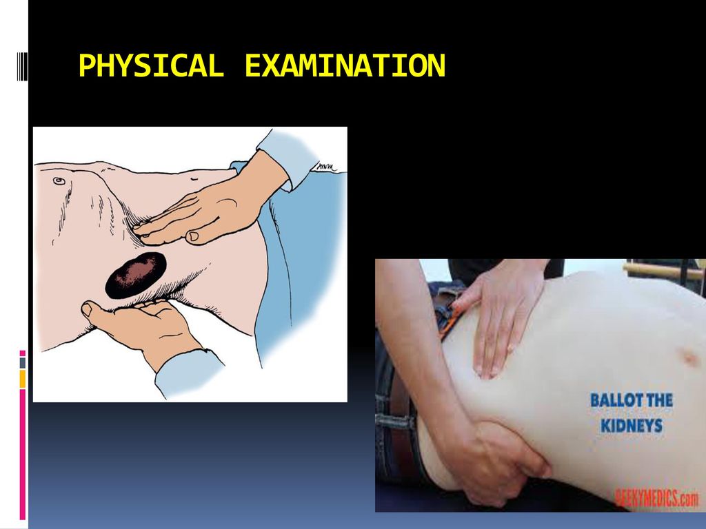 Evaluation of the Urologic Patient - ppt download