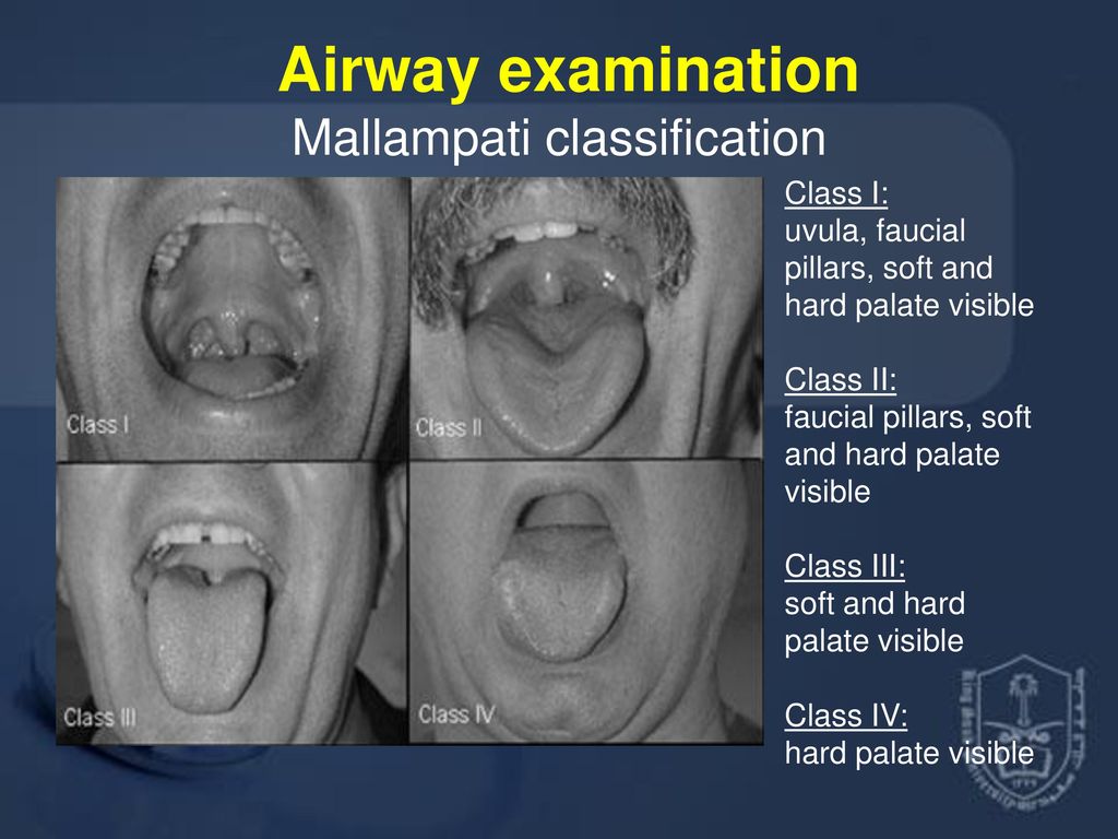 Lecture Title : General Anesthesia - ppt download