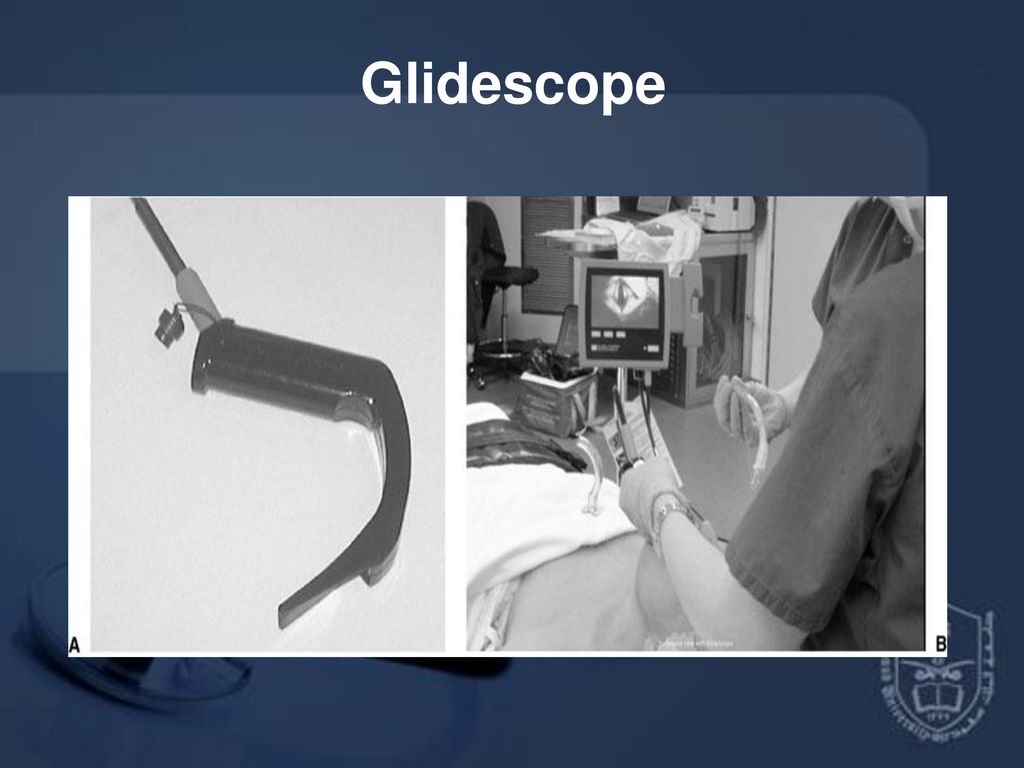 Glidescope