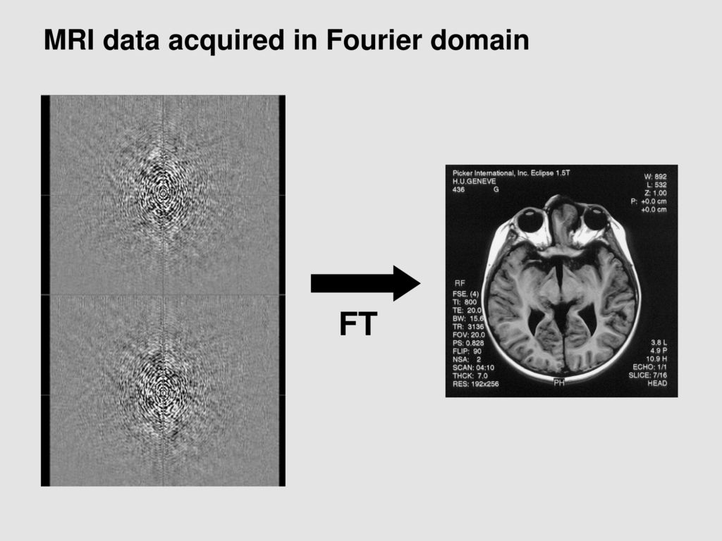 MRI data acquired in Fourier domain
