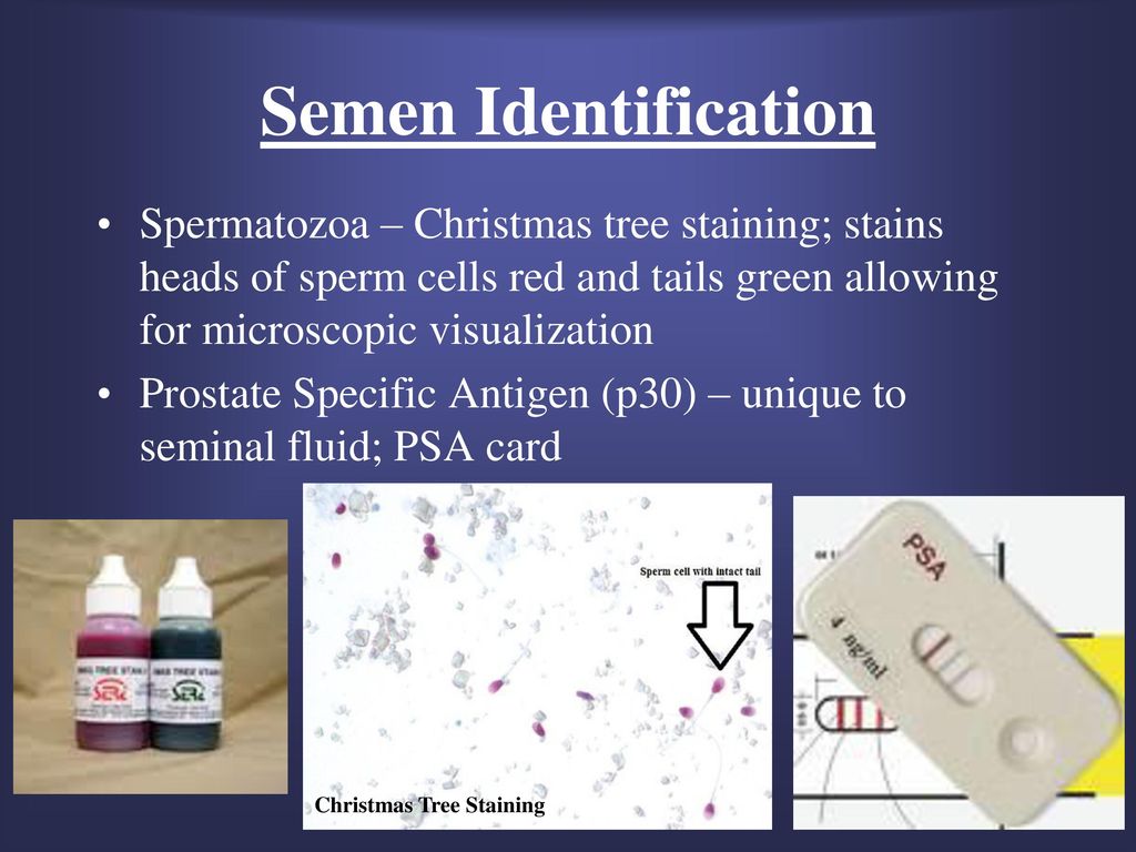 Semen Identification Spermatozoa - Christmas tree staining; stains heads of...