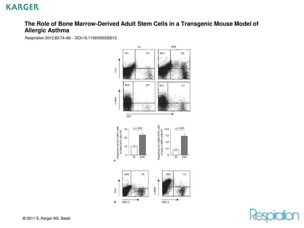The Role of Bone Marrow-Derived Adult Stem Cells in a Transgenic Mouse Model of Allergic Asthma