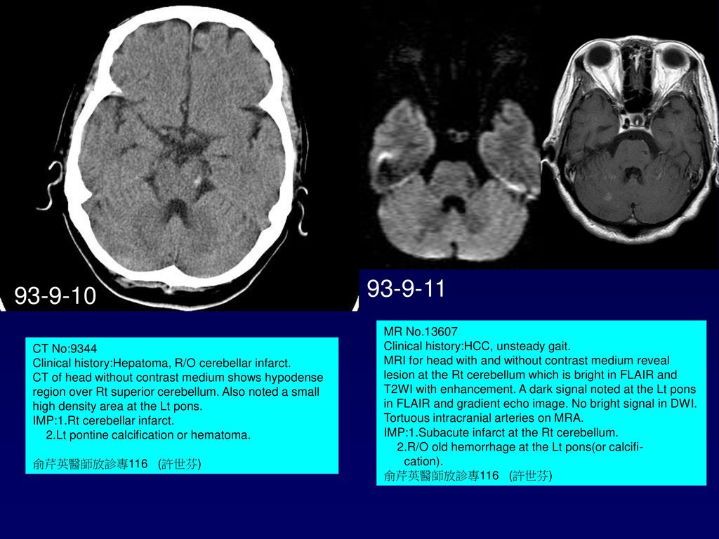 Interventional Case ppt download