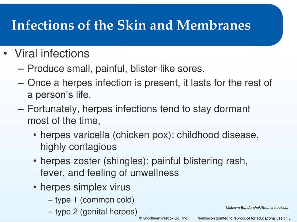 Chapter 3: Membranes and the Integumentary System - ppt download