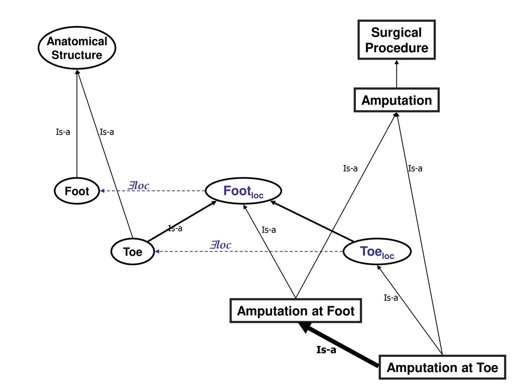 Surgical Procedure Amputation Footloc Toeloc Amputation at Foot