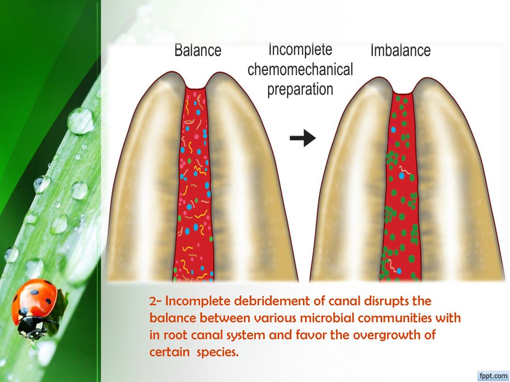 2- Incomplete debridement of canal disrupts the balance between various microbial communities with in root canal system and favor the overgrowth of certain species.