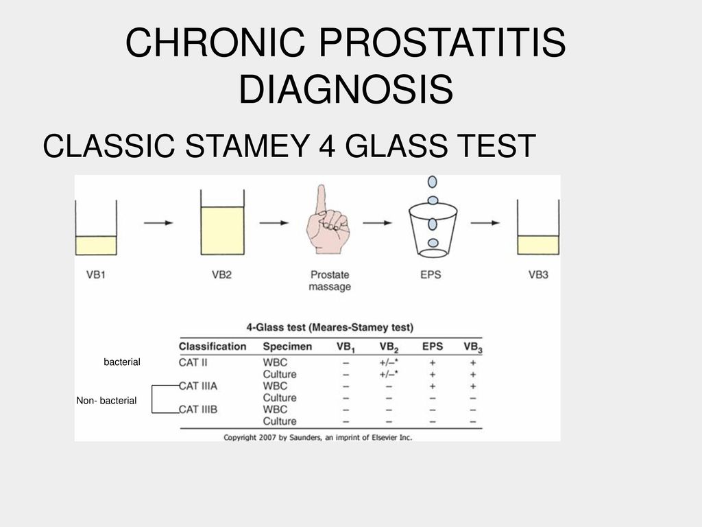 prostatitis diagnosis test