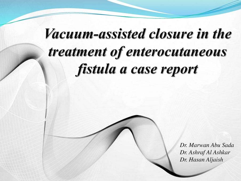 Vacuum-assisted closure in the treatment of enterocutaneous fistula a ...