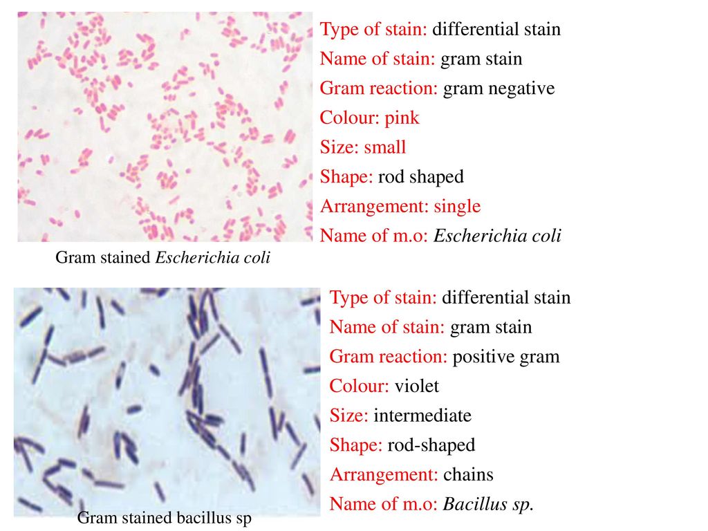 Gram Staining Principle Procedure And Results Msc Sarah Ahmed Ppt Download