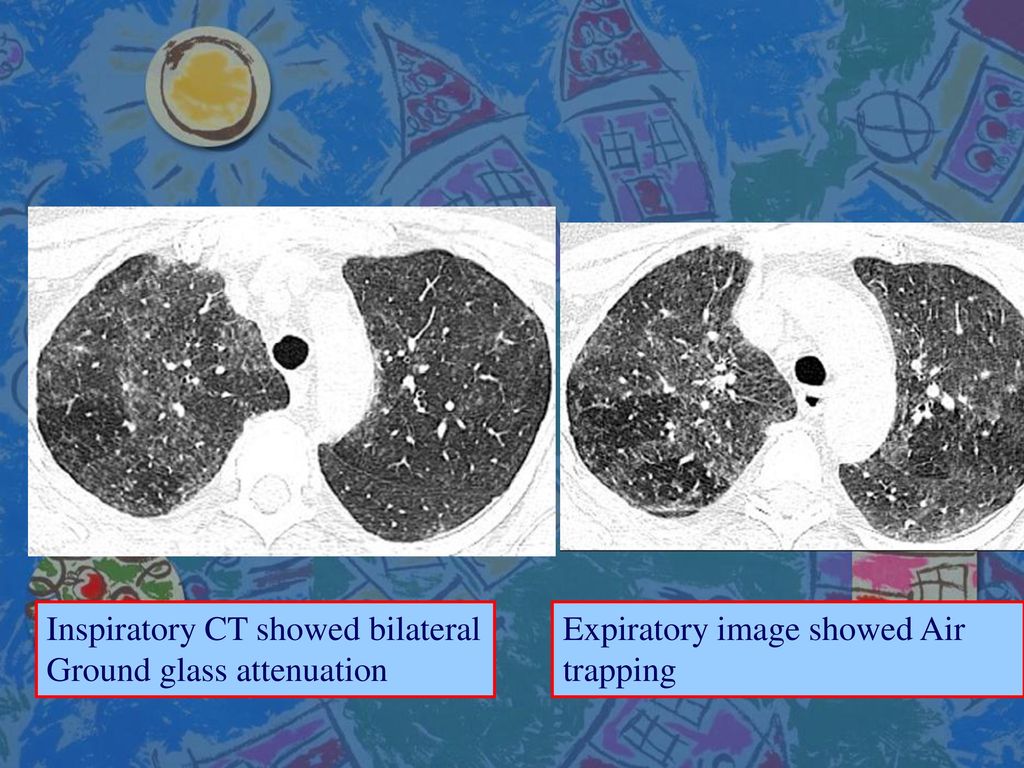 INT 薛乃維 Supervisor: 鄭莉莉醫師 - ppt download