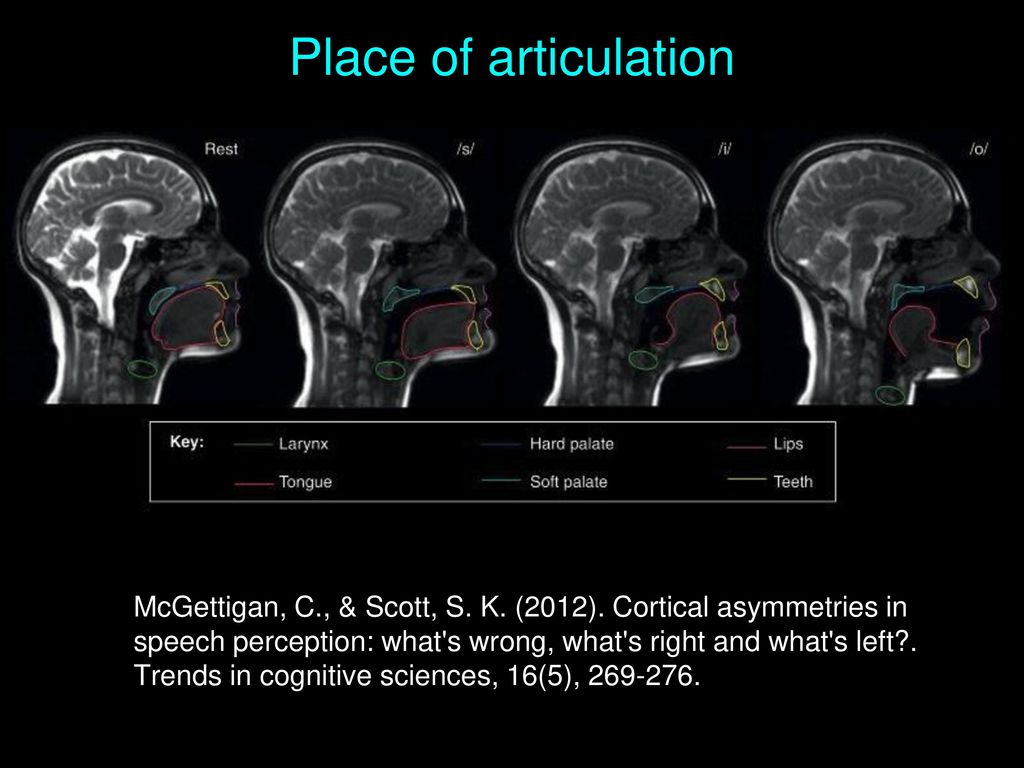 Midterm Post Mortem I Ve Graded About 2 3 Of Them So Far Ppt Download   Place Of Articulation 