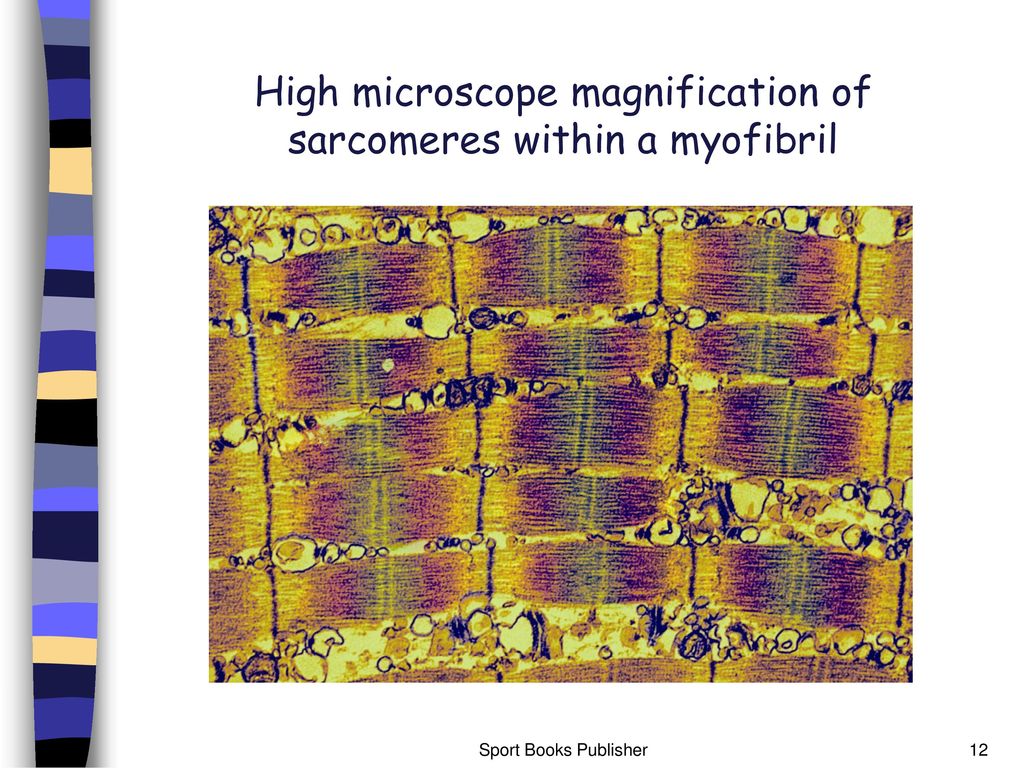 High microscope magnification of sarcomeres within a myofibril