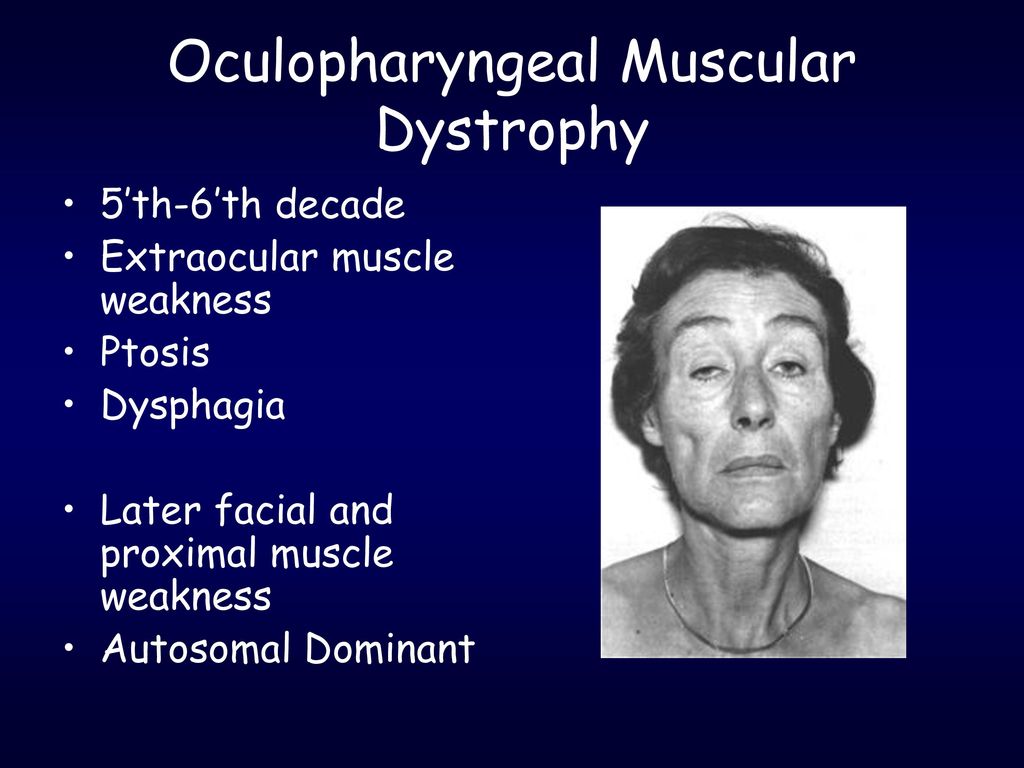 Myopathy Primary Muscle Disease Functional Structural. - ppt download