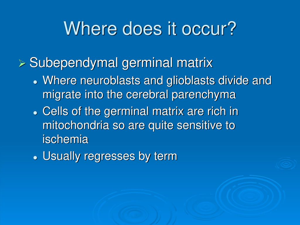 Subependymal