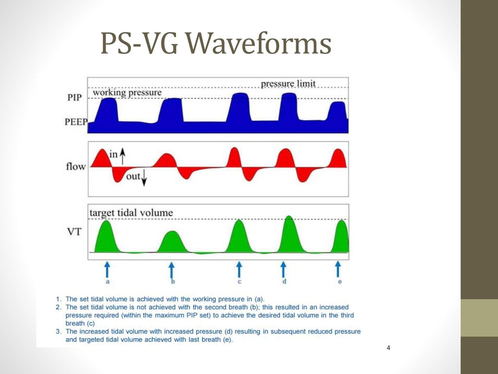 Mechanical Ventilation Of The Pre Term And Term Neonates Ppt Download