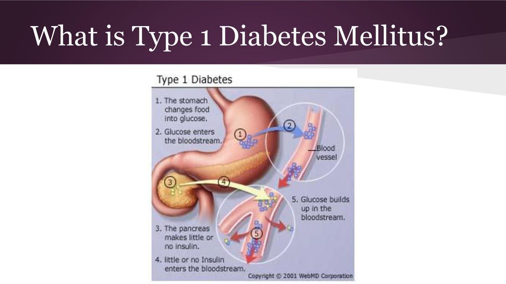 What is Type 1 Diabetes Mellitus