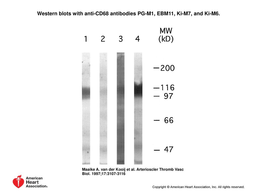 Western blots with anti-CD68 antibodies PG-M1, EBM11, Ki-M7, and Ki-M6.