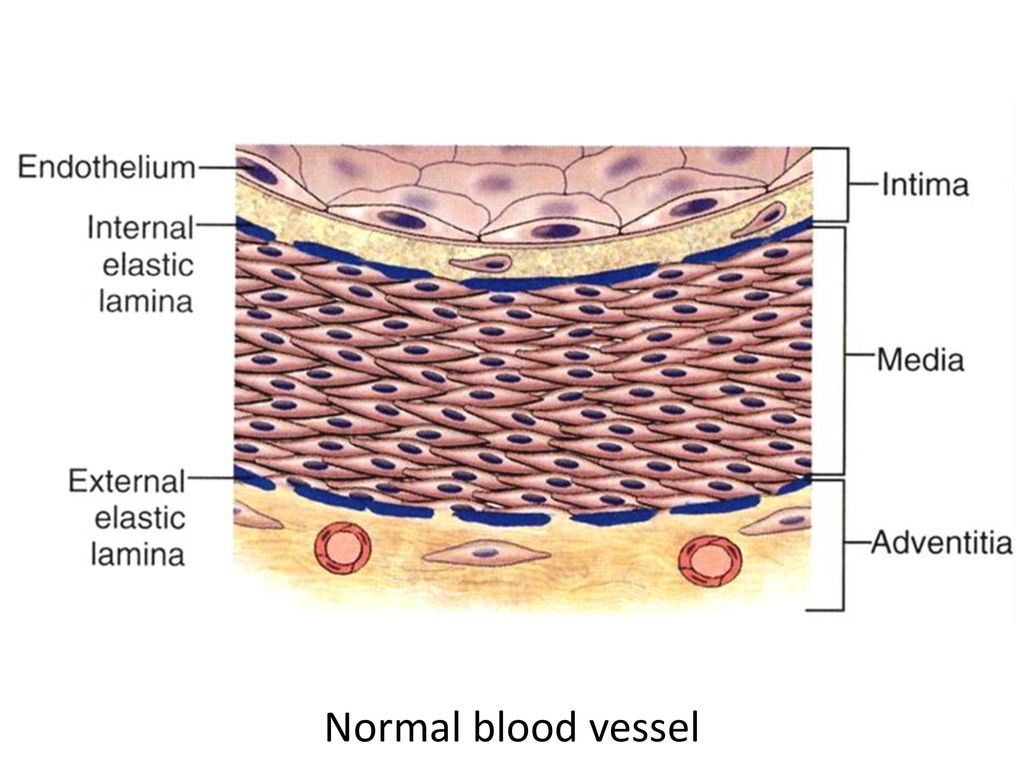 Normal blood vessel