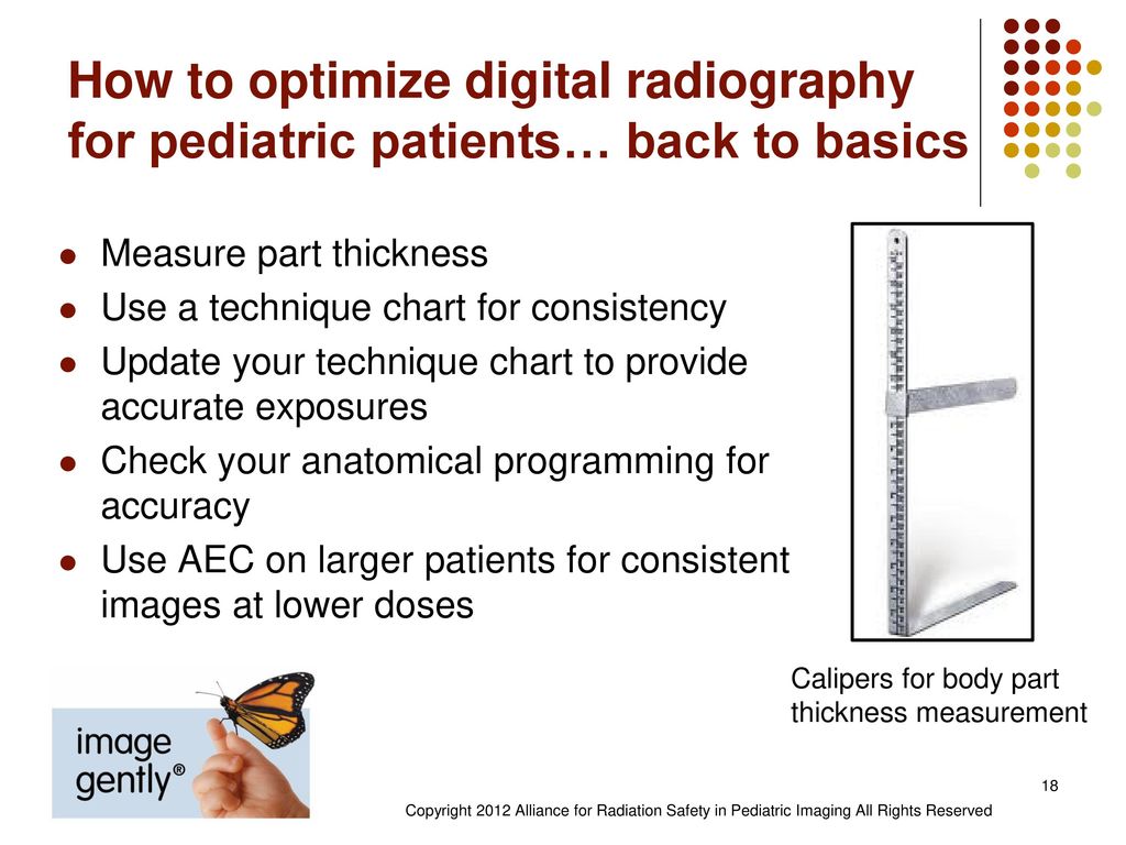 Digital Radiography Technique Chart