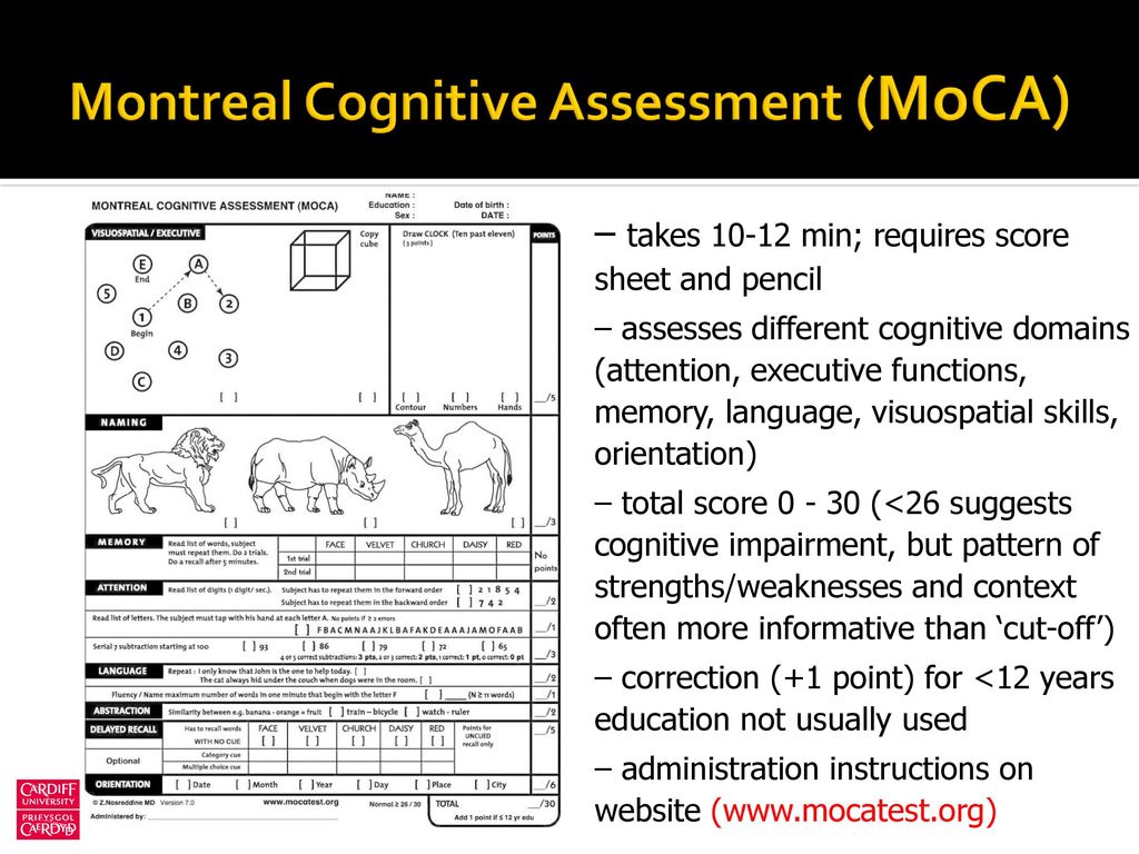 Cognitive Screening Tests Montreal Cognitive Assessment Moca Ppt Download