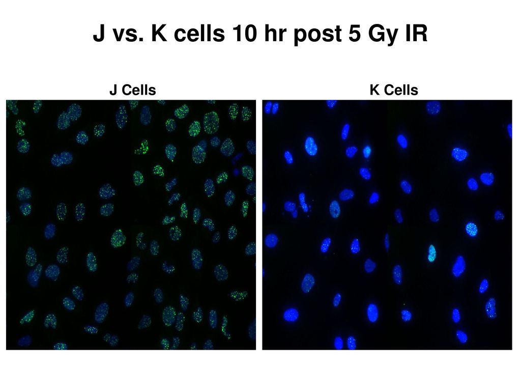 J vs. K cells 10 hr post 5 Gy IR J Cells K Cells