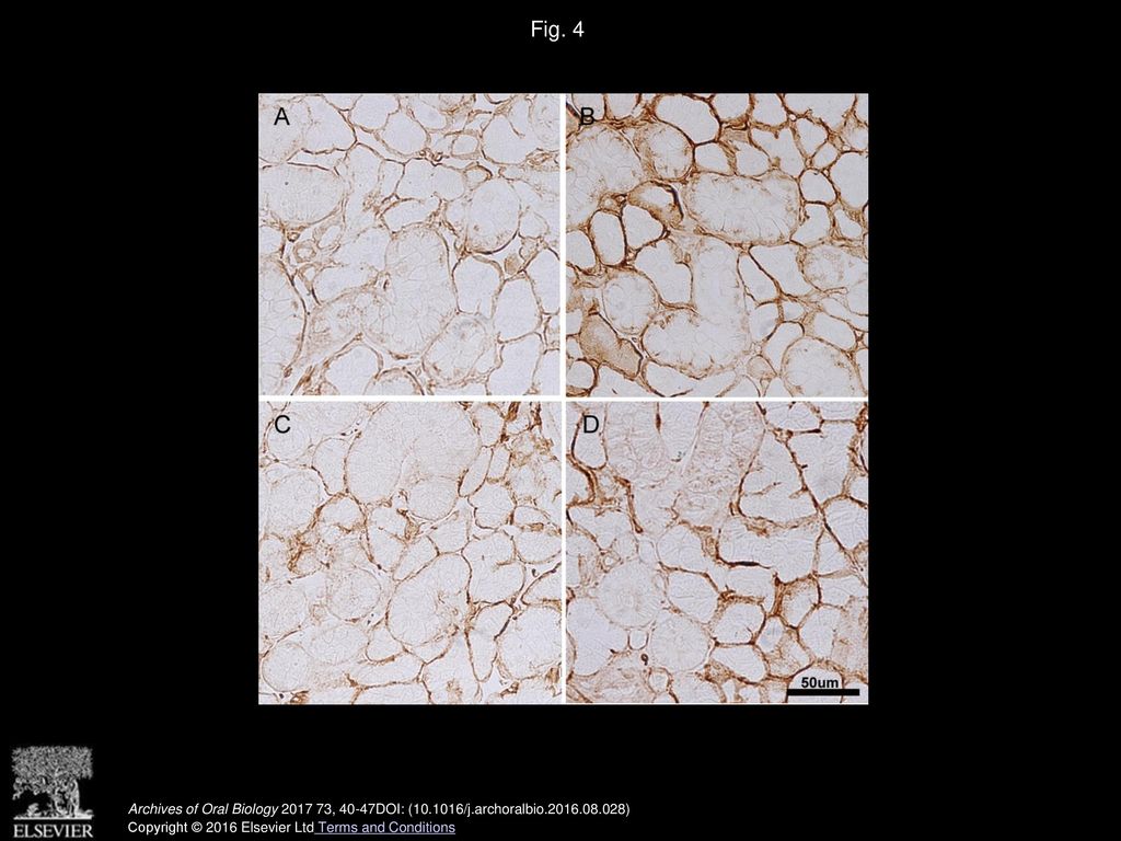 Long- And Short-term Diabetes Mellitus Type 1 Modify Young And Elder ...