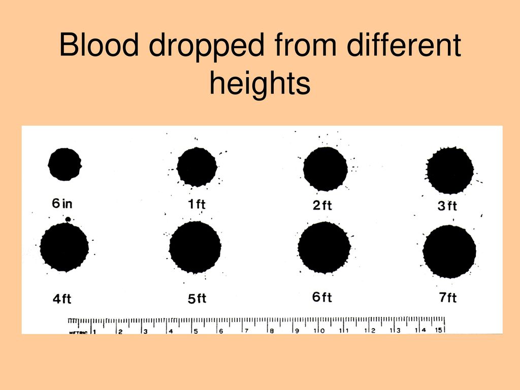 Blood spatter analysis ppt download