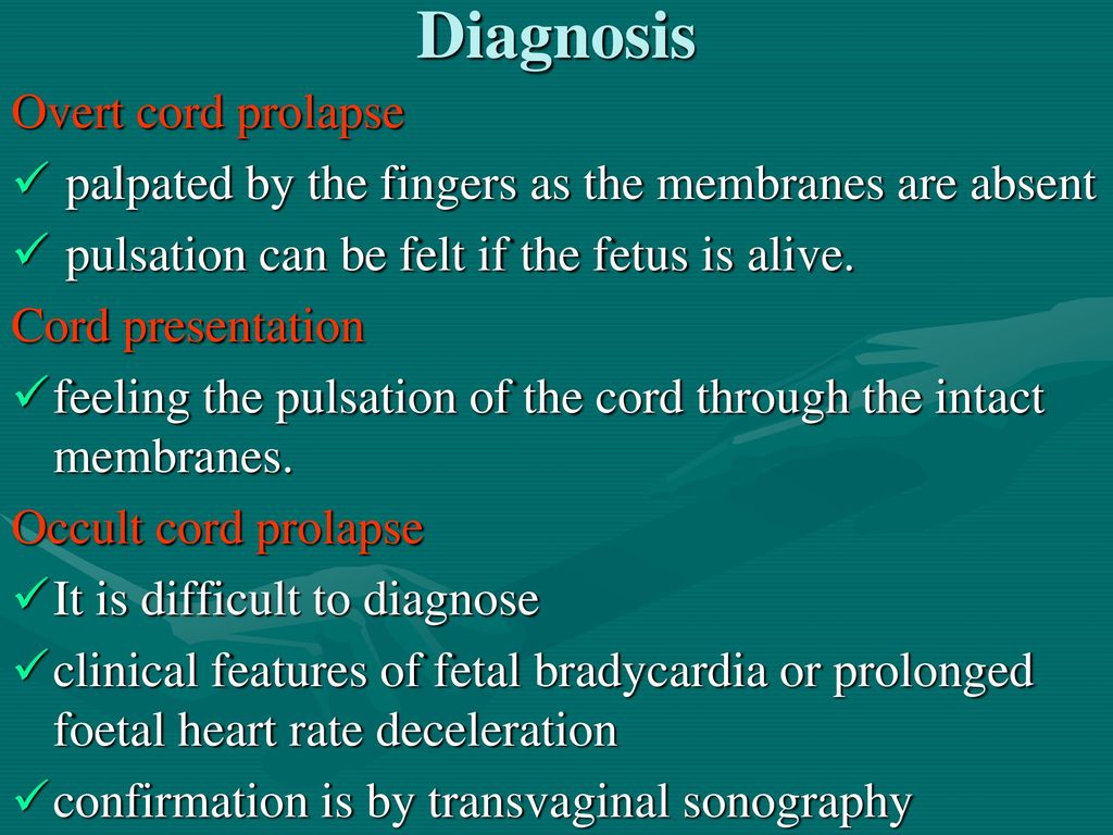 CORD PRESENTATION AND PROLAPSE - ppt download