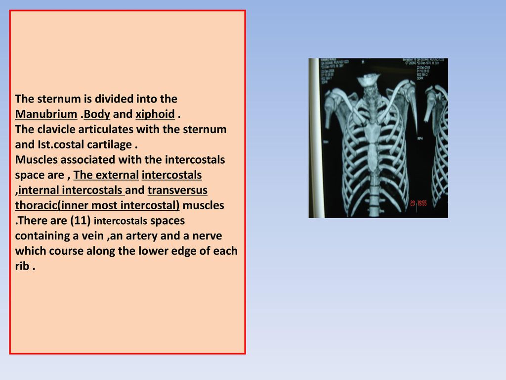 The sternum is divided into the Manubrium. Body and xiphoid