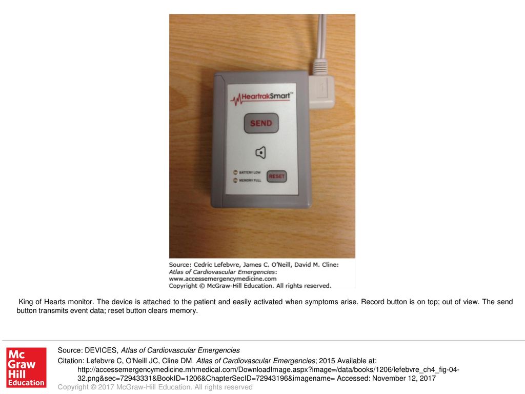 King of Hearts monitor. The device is attached to the patient and