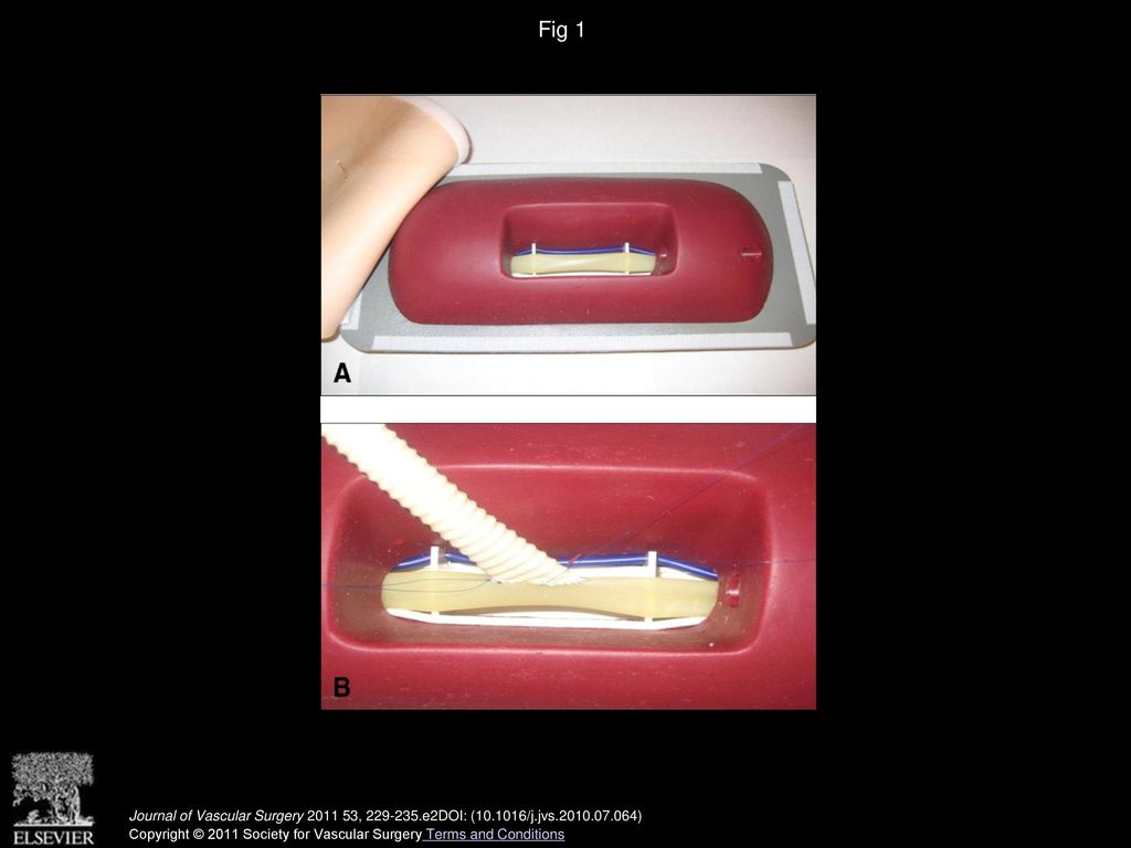 Fig 1 A, Femoro-Peroneal Anastomosis trainer (Limbs & Things). B, Close-up view of simulated anastomosis.