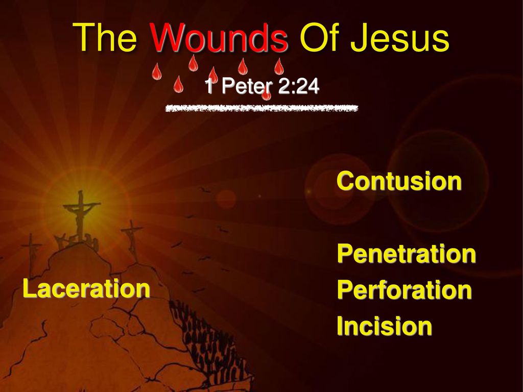 The Wounds Of Jesus Contusion Penetration Laceration Perforation