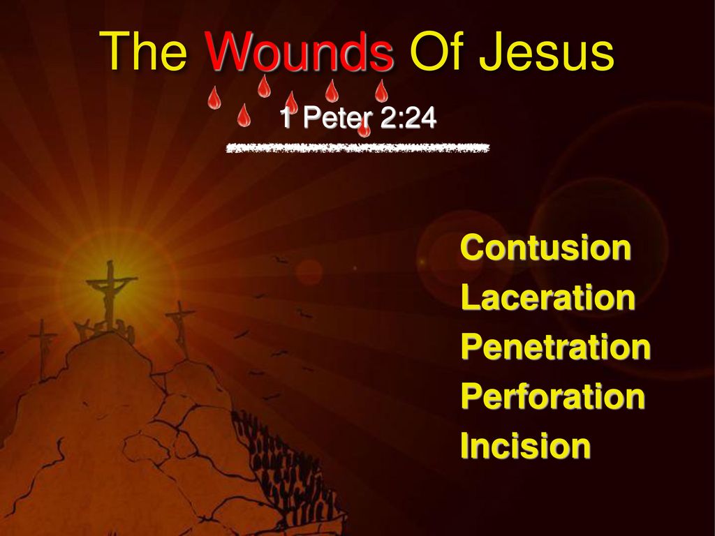 The Wounds Of Jesus Contusion Laceration Penetration Perforation