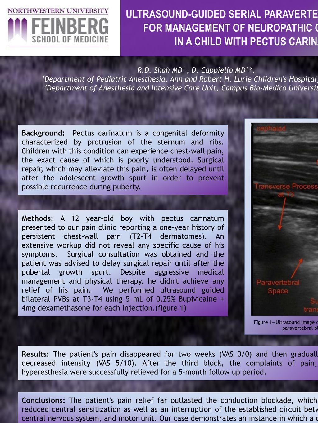 Figure 1—ultrasound image of ultrasound-guided paravertebral blockade