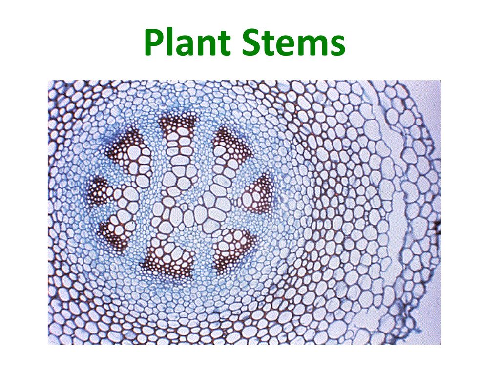 Какой микропрепарат изображен на рисунке. Ксилема микроскоп. Ксилема микропрепарат. Проводящая ткань под микроскопом. Проводящая ткань растений под микроскопом.