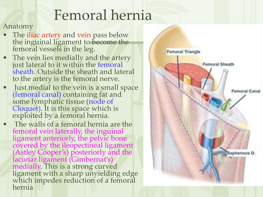 Femoral hernia Anatomy.